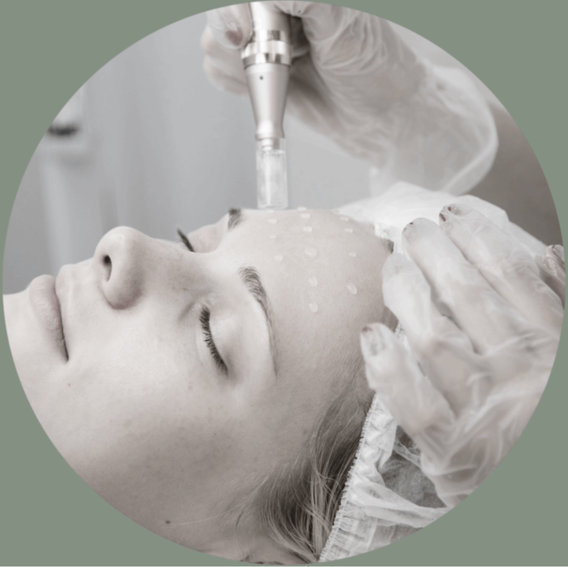Copertina del corso Microneedling