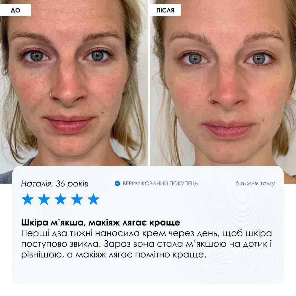 Night Retinol Cream — нічний ANTI-AGE крем з мікроголками та ретинолом ROBEAUTY — фото 6 з 9