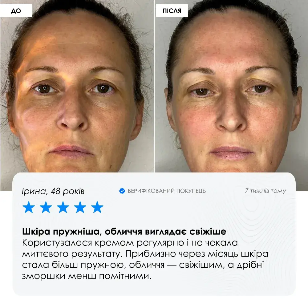 Night Retinol Cream — нічний ANTI-AGE крем з мікроголками та ретинолом ROBEAUTY — фото 8 з 9