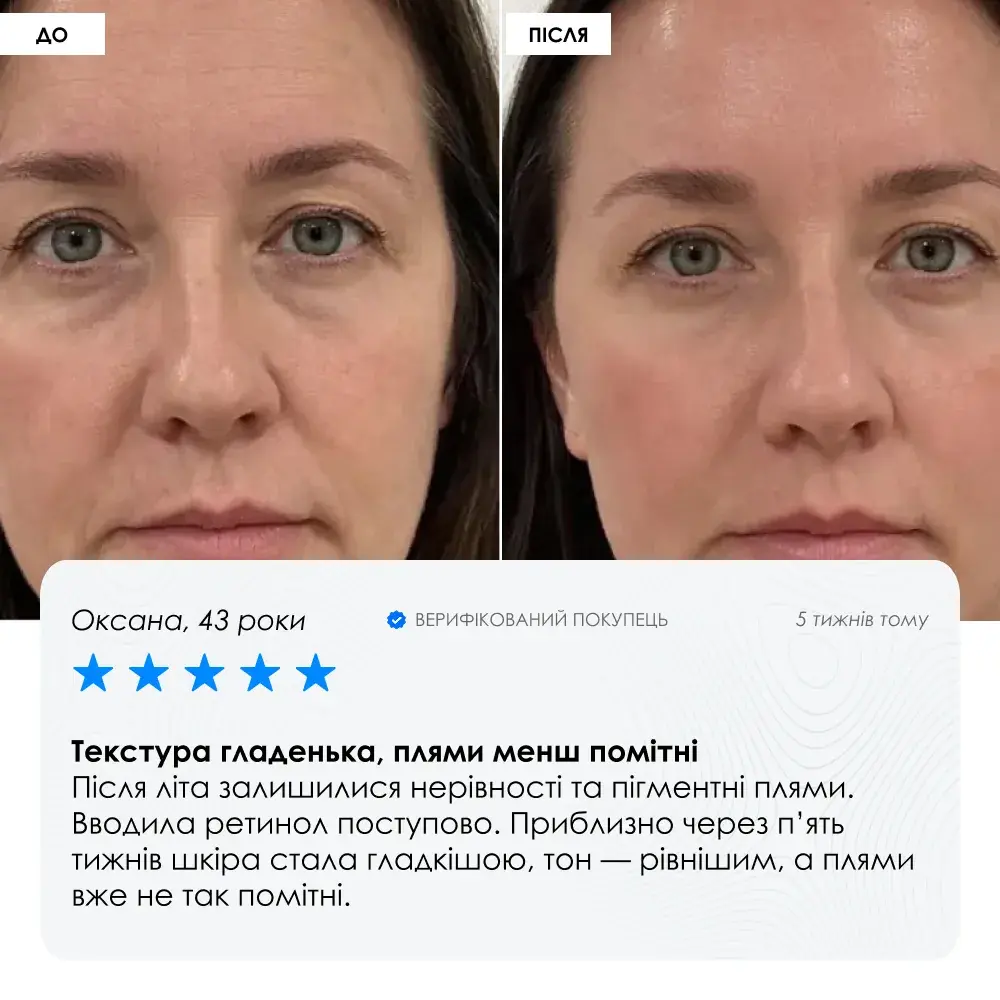 Night Retinol Cream — нічний ANTI-AGE крем з мікроголками та ретинолом ROBEAUTY — фото 7 з 9