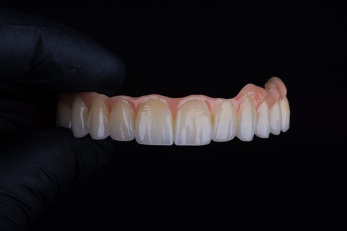 Dental Implants