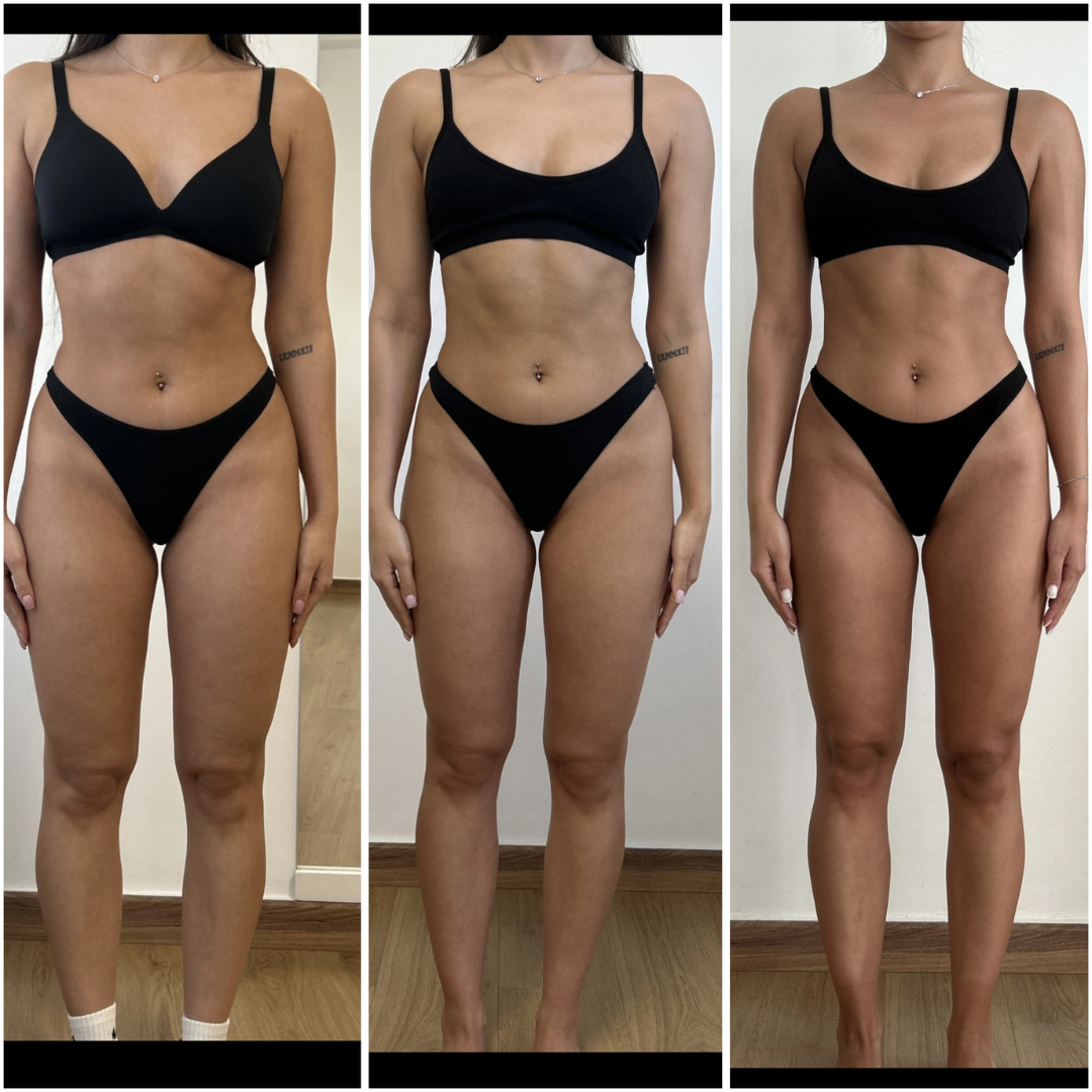 Trasformazione cliente ABT Fitness Boutique