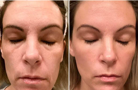 Night Retinol Serum 30 мл — нічна сироватка з ретинолом