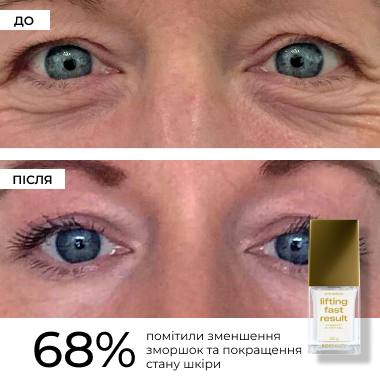 Сироватка для підтяжки нижньої повіки Lifting Fast Result Eye Serum