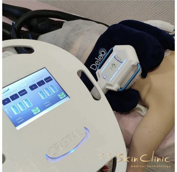 Обладнання та процедури SkinClinic: Cristal