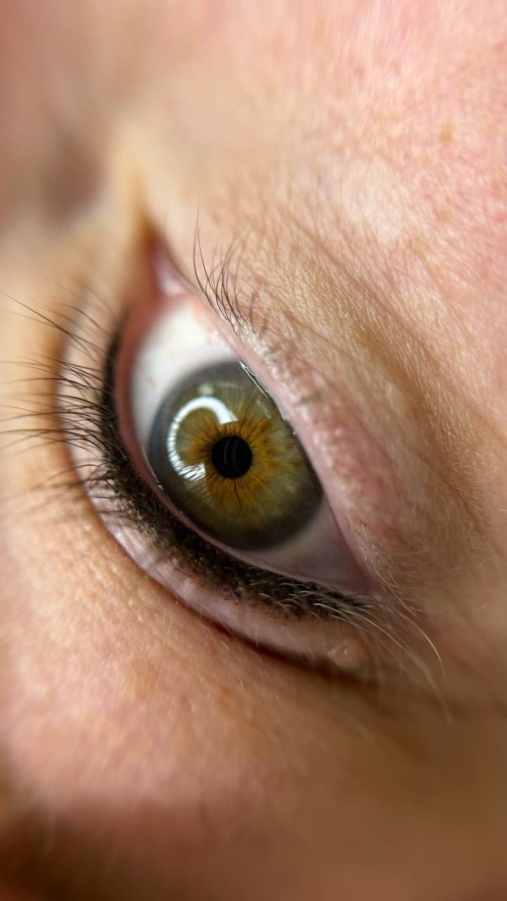 Lashline result