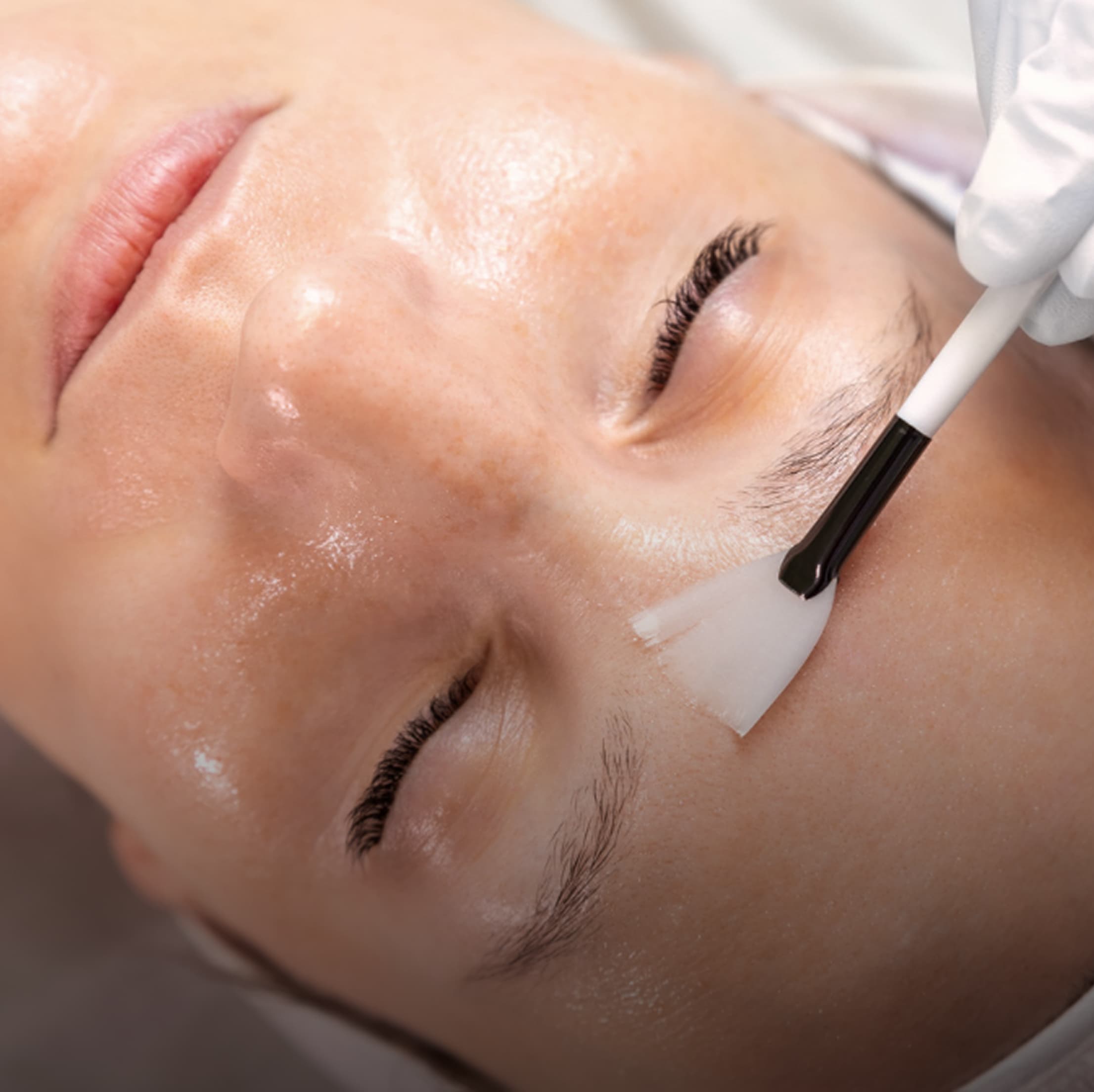 Exosomes Regenerative Facial in Burbank
