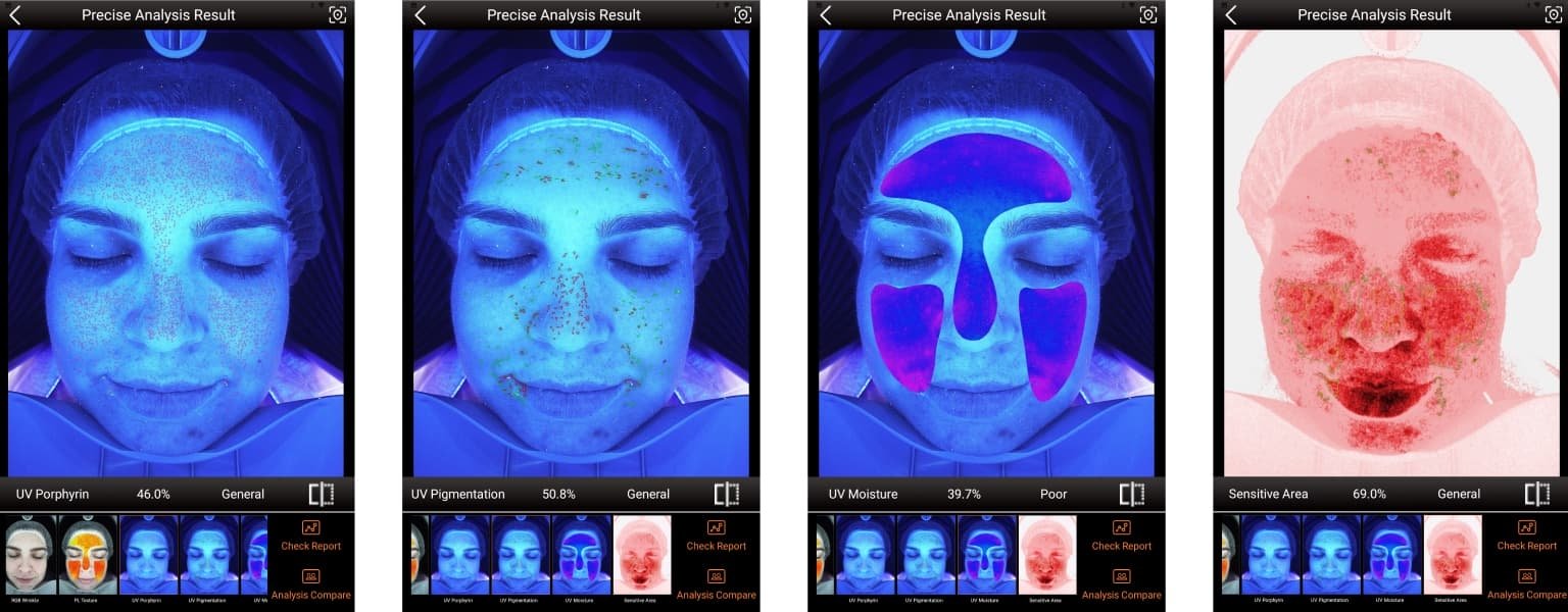 Zemits VeraFace Skin Analyzer Professional Skin Analysis System