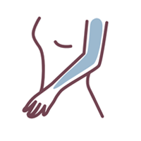 Full arms — laser hair removal area shown in blue