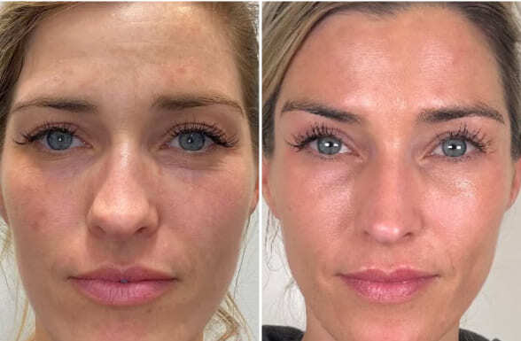 Night Retinol Cream 50 мл — нічний крем з ретинолом