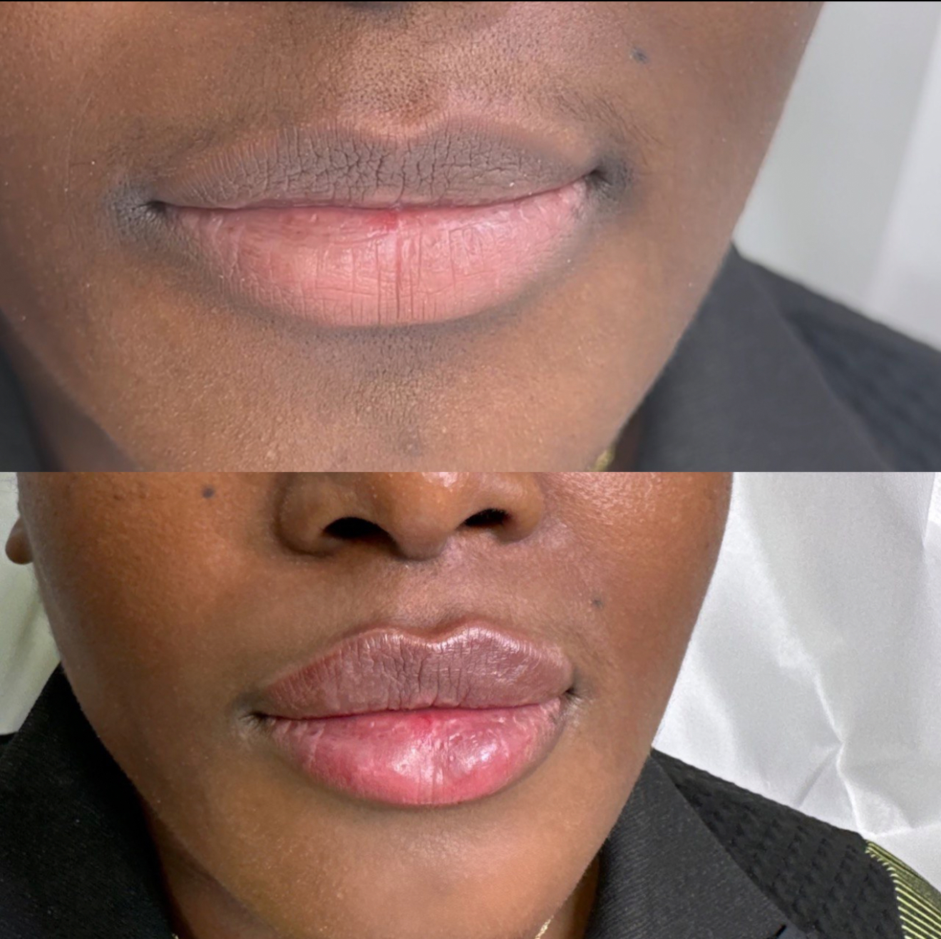 Lip Enhancement Results