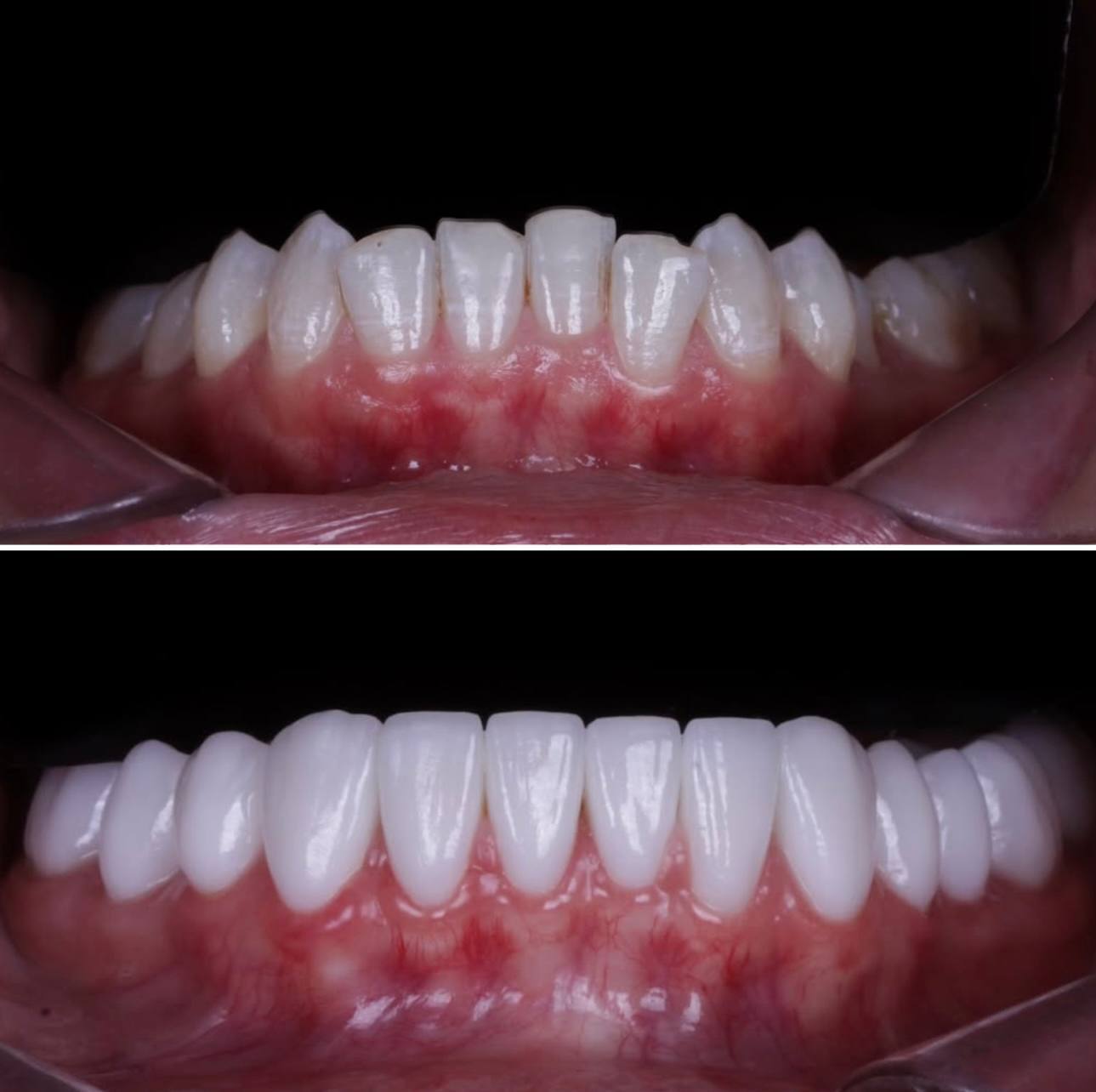 Dental smile transformation patient results