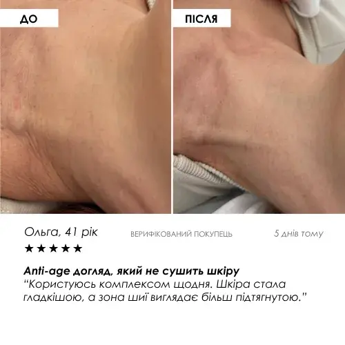 Набір Ліфтинг-регенерація 4 в 1 ROBEAUTY — фото 8 з 9