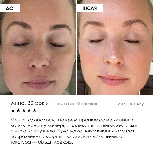Liposomal Vitamin C Cream ROBEAUTY 50 мл — фото 7 з 9
