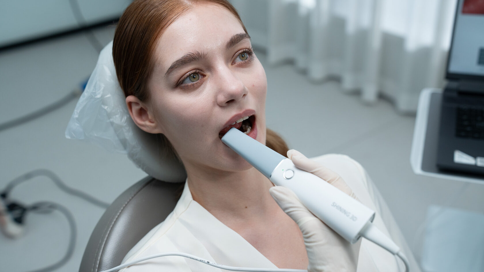 Shining Aoralscan Lync