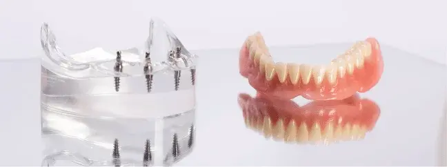 Removable Partial Denture