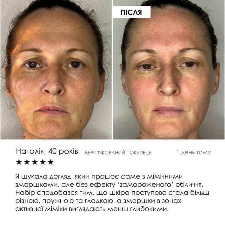 MAX ліфтинг — фото 8