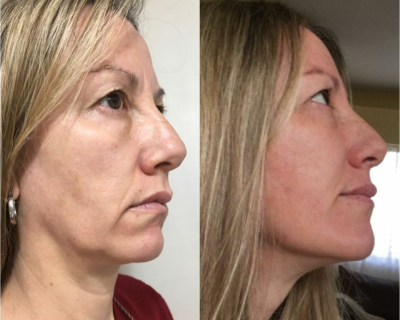 Arcjóga eredmény 1