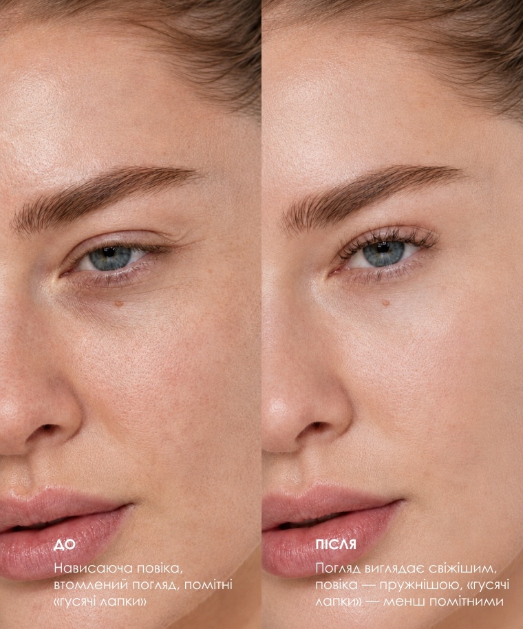 Набір BEAUTIFEYE® для зони очей