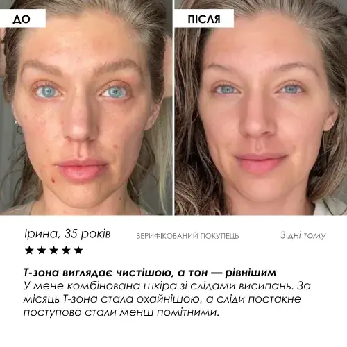 Набір Догляд 360° — фото 8 з 9