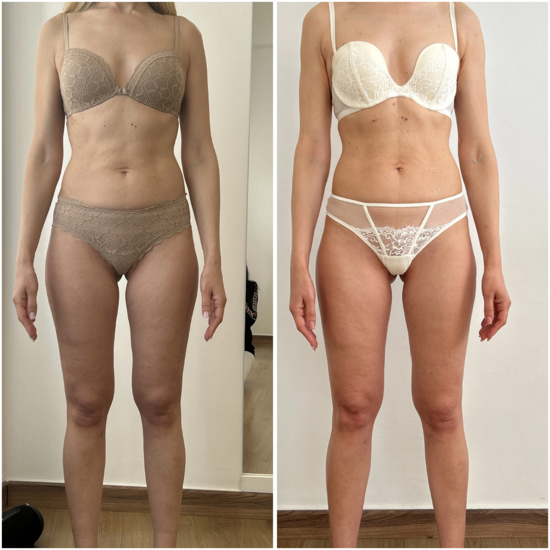 Trasformazione cliente ABT Fitness Boutique