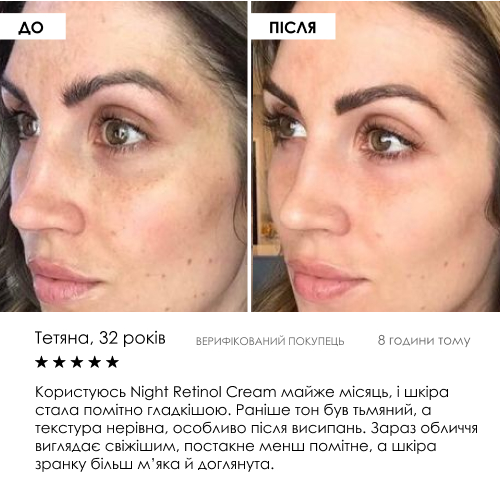 Liposomal Vitamin C Cream ROBEAUTY 50 мл — фото 6 з 9
