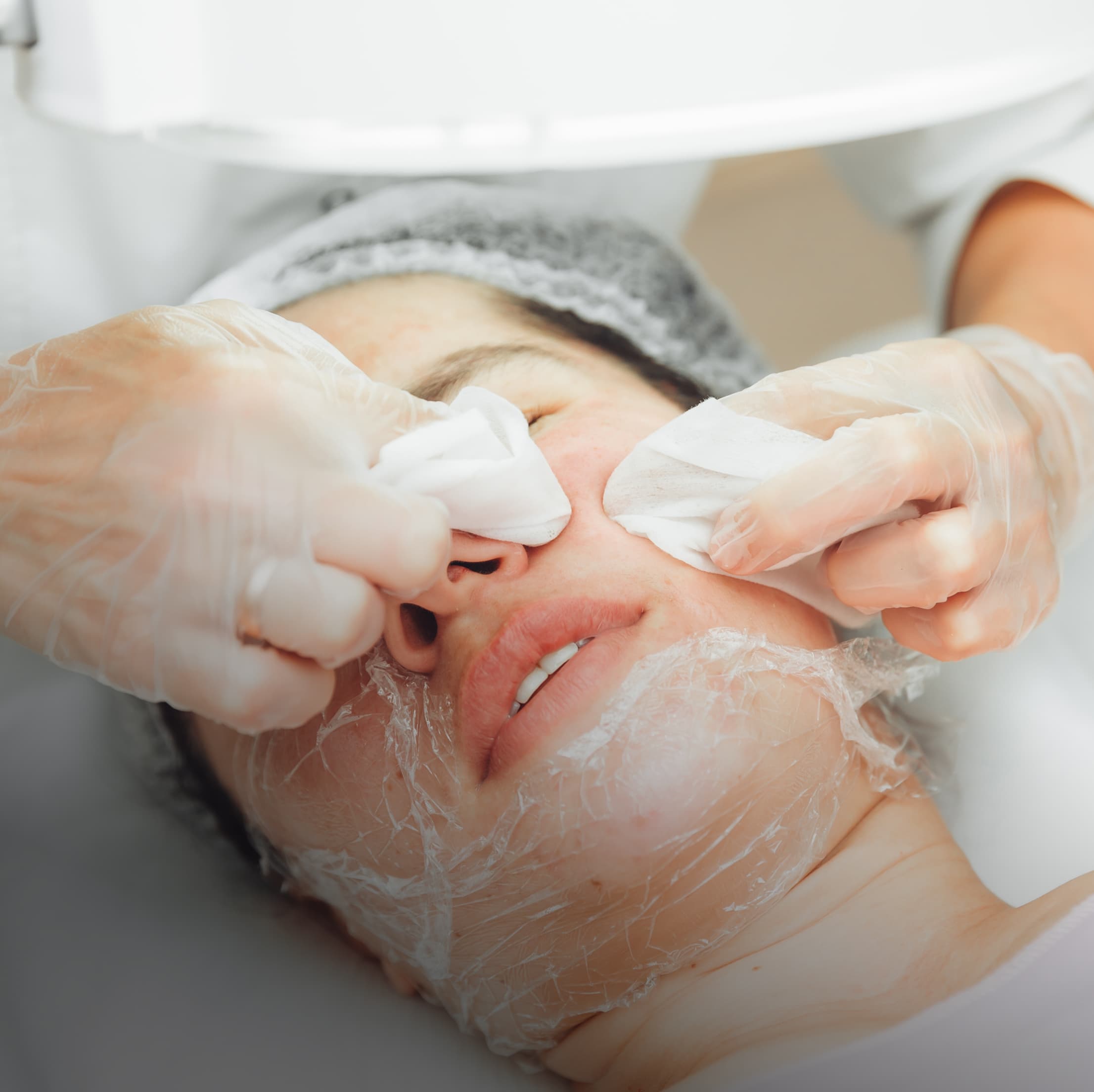 Acne Clarifying Facial treatment in Burbank at NewSkinLA skincare studio