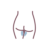 Bikini line — back view, treated area in blue