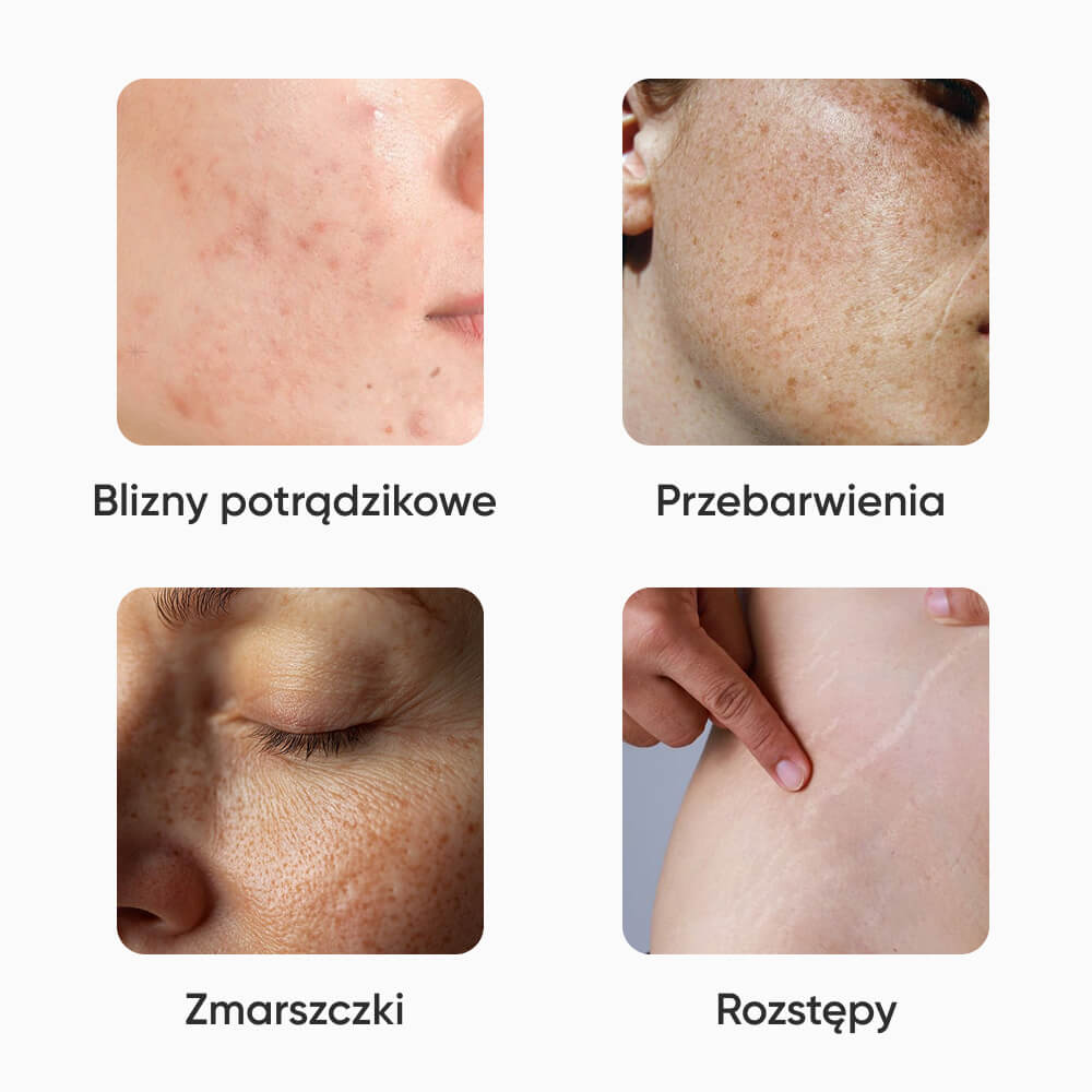 Zemits — ilustracja do artykułu