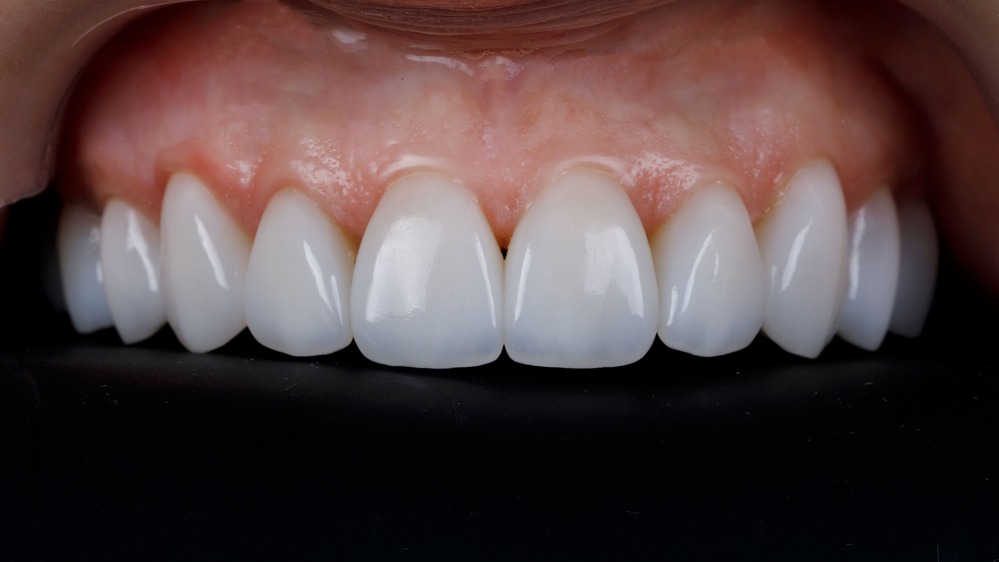 Cosmetic Dentistry