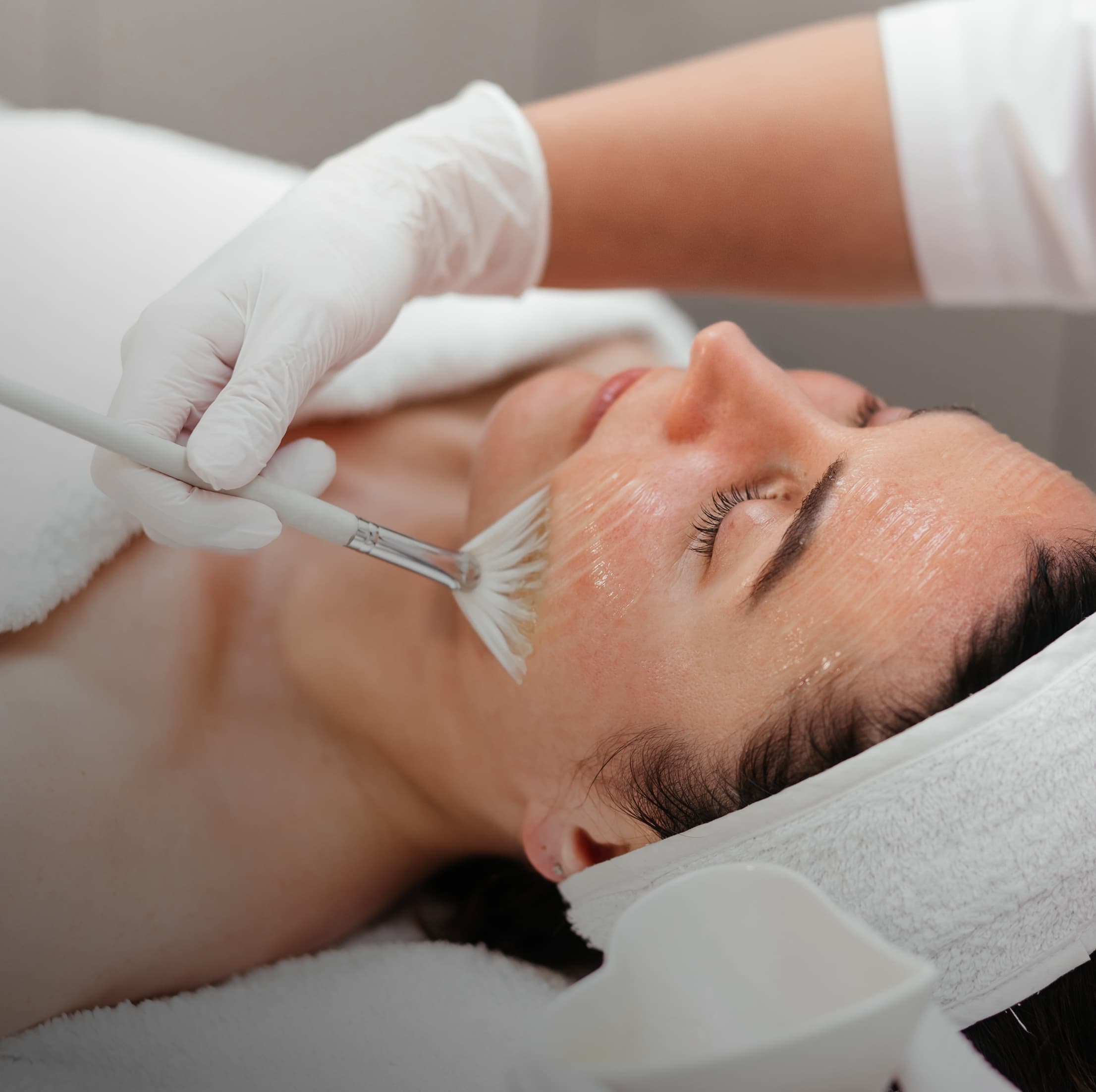 Jessner Peel treatment in Burbank at NewSkinLA skincare studio