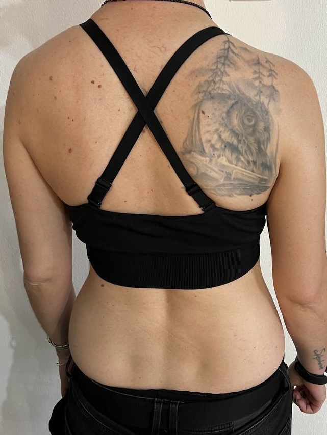 Verblasstes Eulen-Tattoo am Schulterblatt vor dem Cover-Up