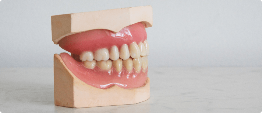 Dental prosthetics in Torrevieja at Dental Family Bushin