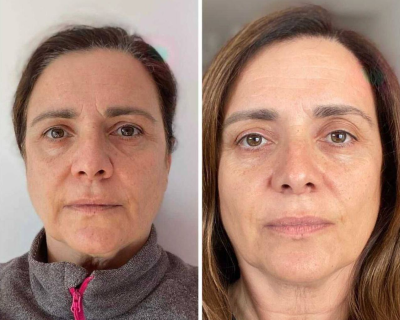 Arcjóga eredmény 2