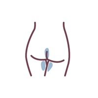 Brazilian — back view, treated area in blue