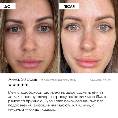 Liposomal Vitamin C Serum ROBEAUTY 30 мл — фото 7 з 9