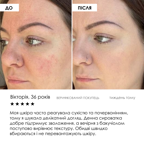 Набір сироваток «День + Ніч» ROBEAUTY — фото 7