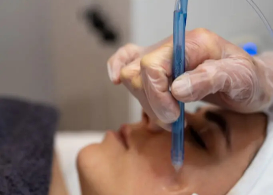 JetPeel + Laser Behandlung