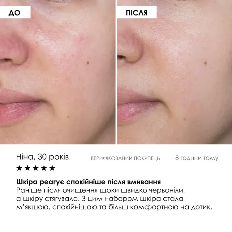 Набір «WELCOME KIT: Ваш старт догляду для обличчя» ROBEAUTY — фото 6 з 9