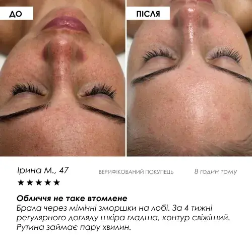 Набір Ліфтинг-регенерація 4 в 1 ROBEAUTY — фото 6 з 9