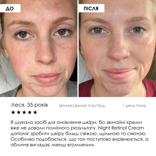 Liposomal Vitamin C Serum ROBEAUTY 30 мл — фото 8 з 9