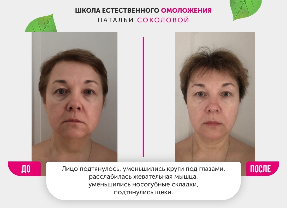 Школа омоложения натальи соколовой. Омоложение естественно мичуринский. Школа омоложения натальи соколовой. Smas лифтинг. Упражнения от отеков лица.
