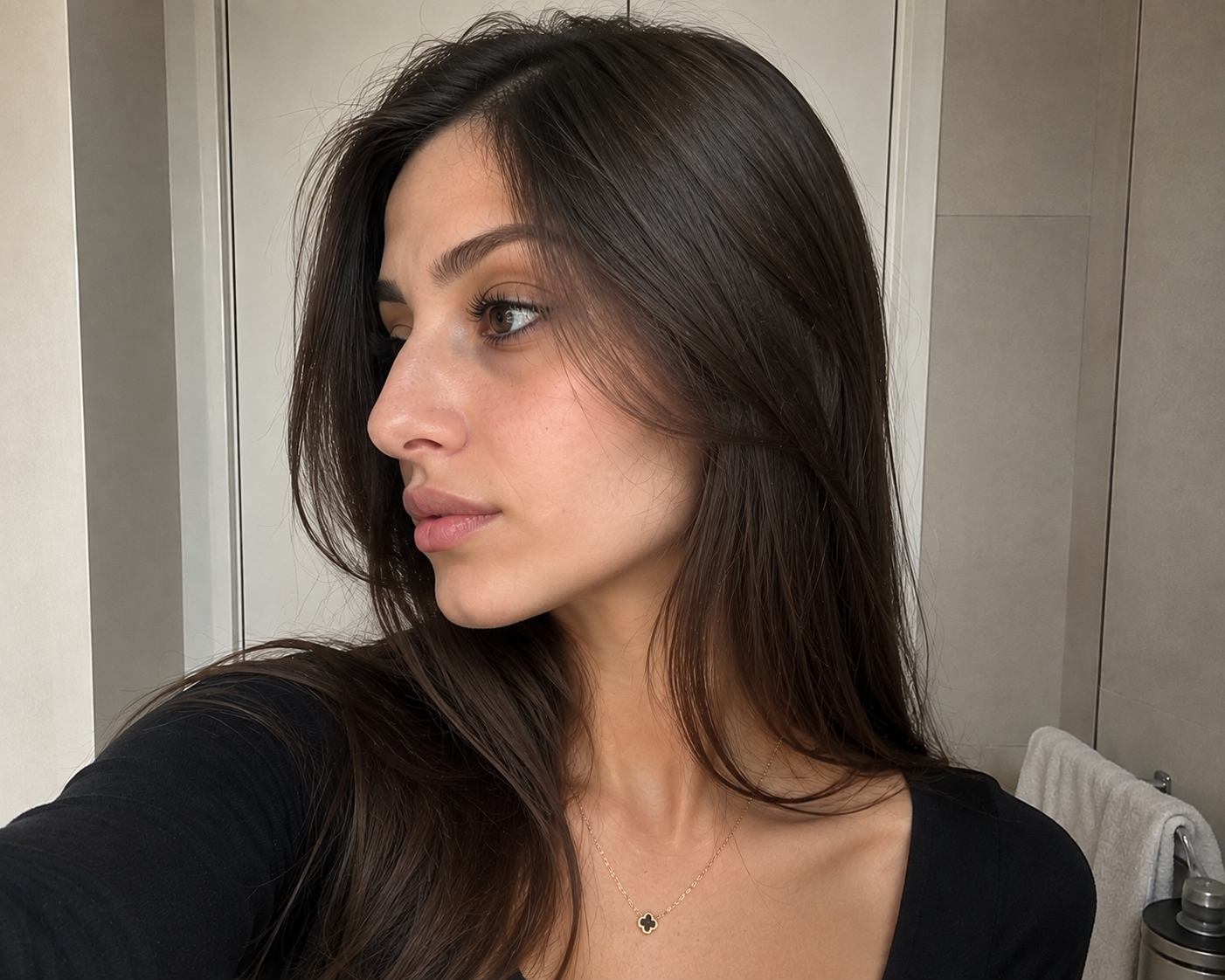 Rhinoplasty — before