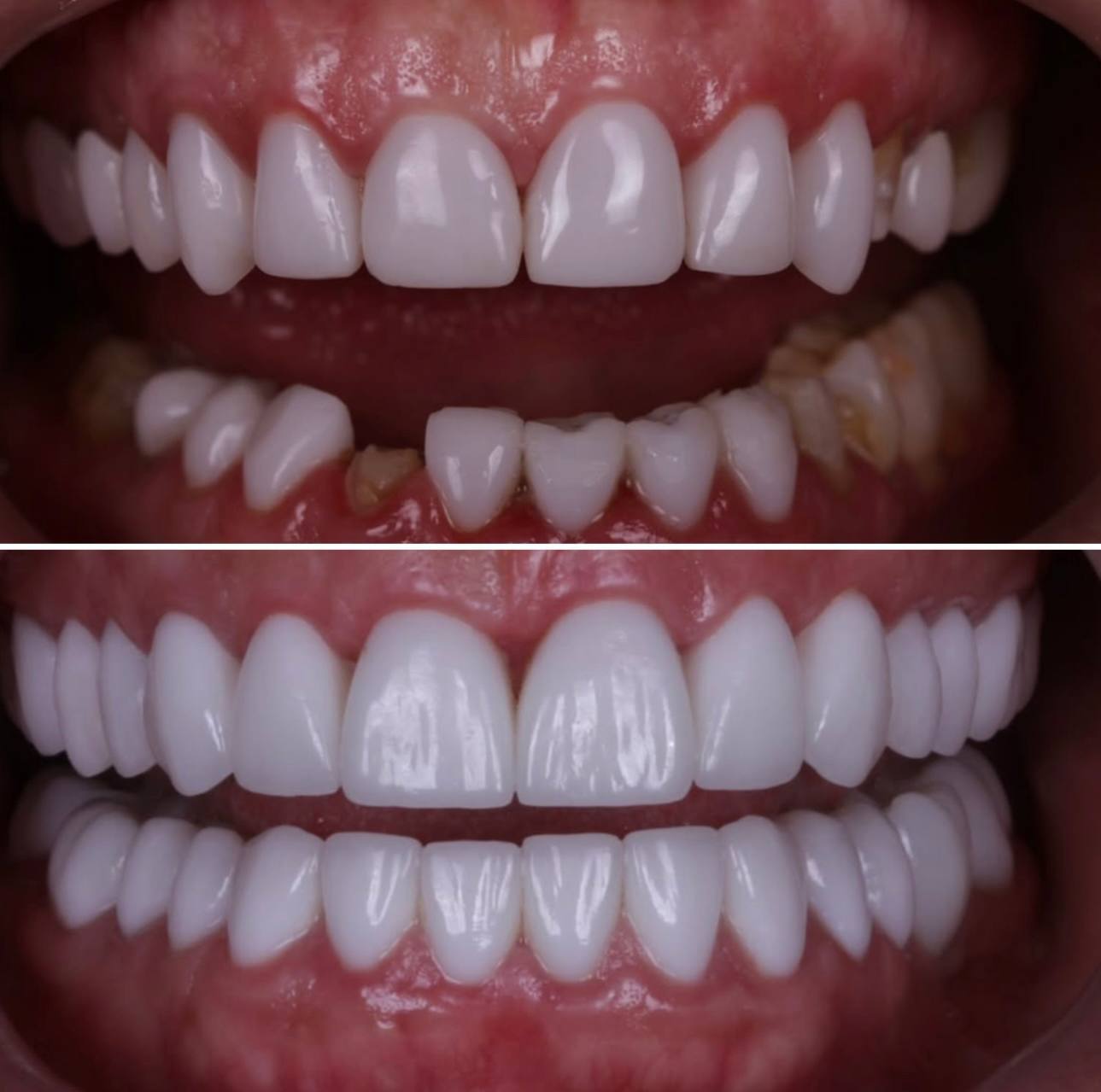 Modern dental implant x-ray scan