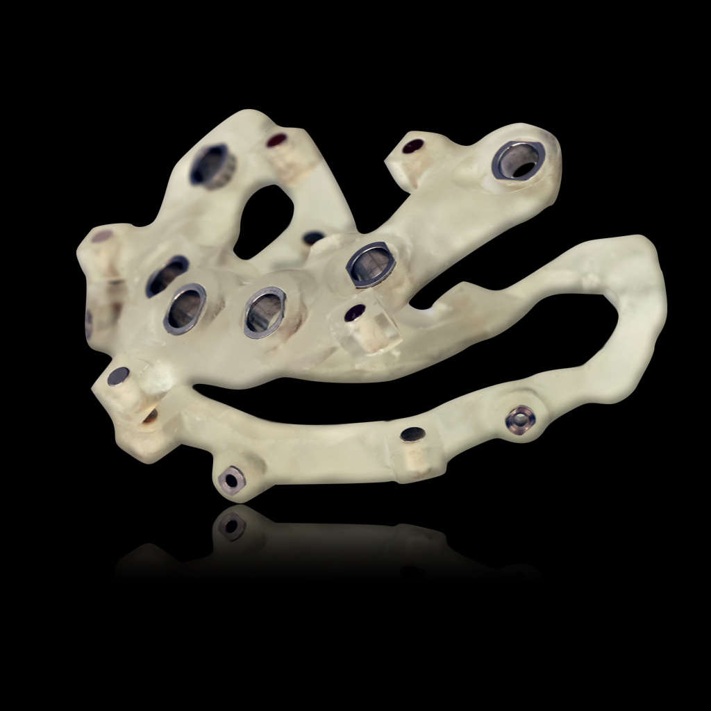 Dental implant all on x surgical guide, surgical guide resin, dental implant, glidewell, stackable surgical guide
