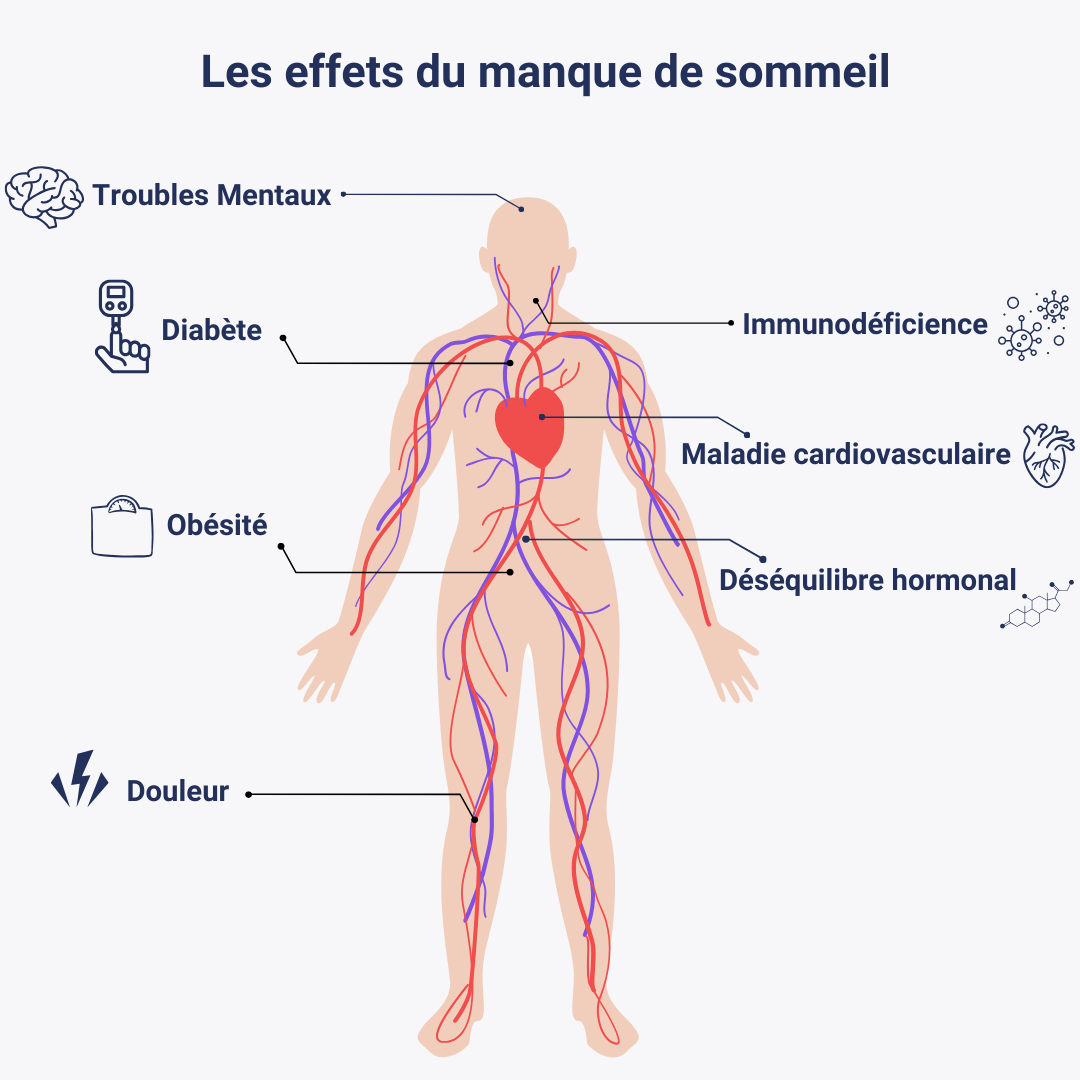 Manque de sommeil ce qu'il faut savoir — free download