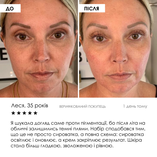 Набір сироватка та крем з ліпосомальним вітаміном C ROBEAUTY — фото 8 з 9