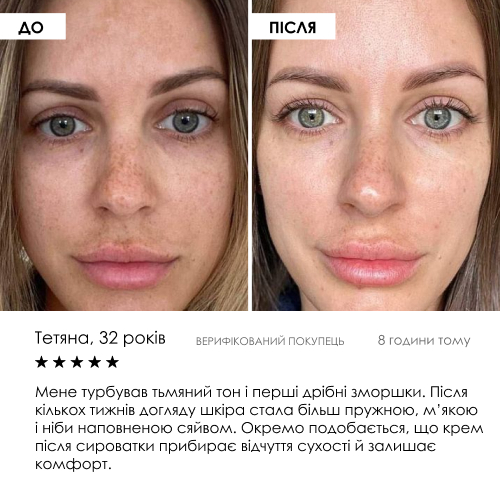 Набір сироватка та крем з ліпосомальним вітаміном C ROBEAUTY — фото 6 з 9
