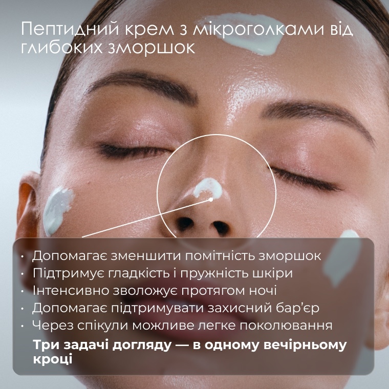 Крем з мікроголками: як працюють спікули і що обрати