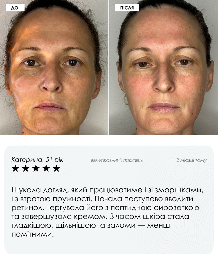 Протокол з мікроголками — кадр 8